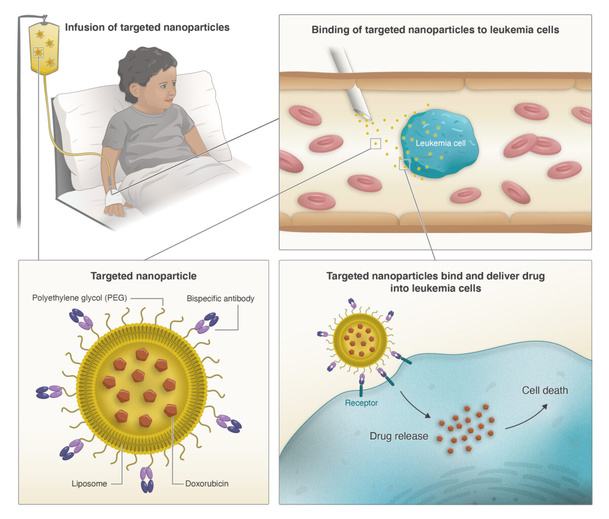 Schematic of PEGylated liposomal doxorubicin delivery.